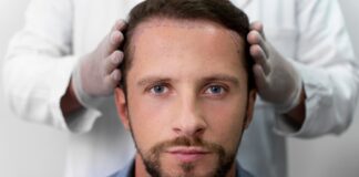 Hair Transplant